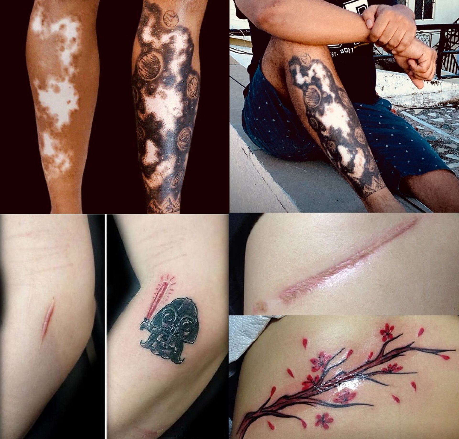 Scar Tattoo Cover up-9 - EdgyMinds